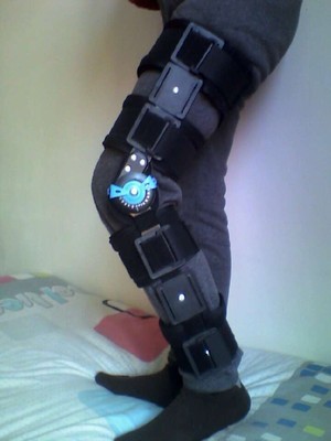 醫用膝關節外固定支具下肢骨折韌帶損傷脛腓骨矯形器可調支具支架批發・進口・工廠・代買・代購